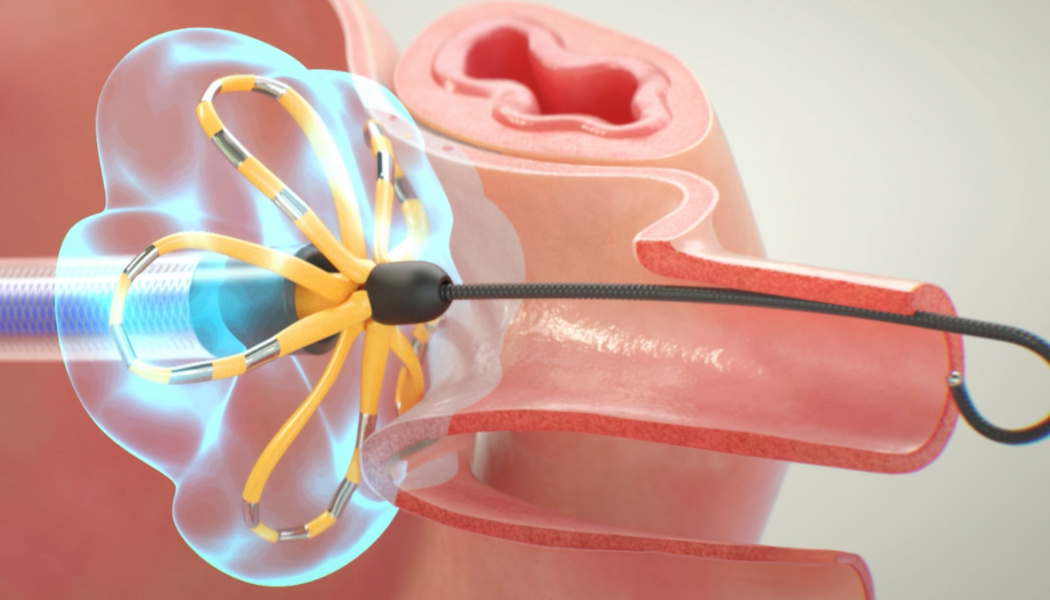 Name of feature or technology.