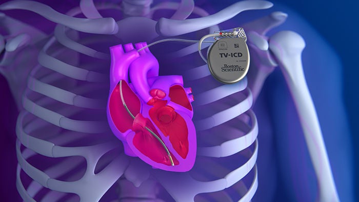 Example image.